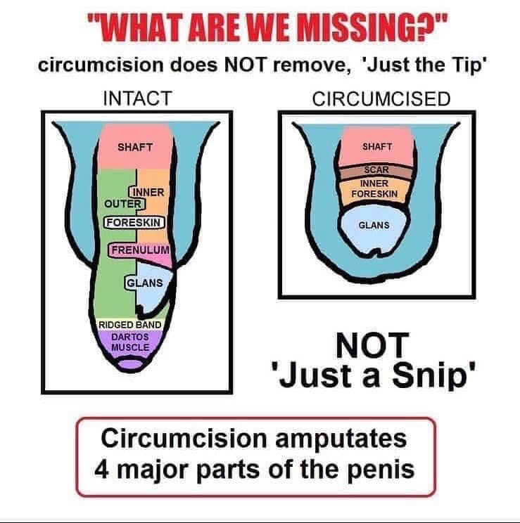 Male Circumcision The Unkindest Cut Freshmag