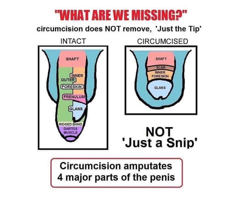 Male Circumcision: The Unkindest Cut