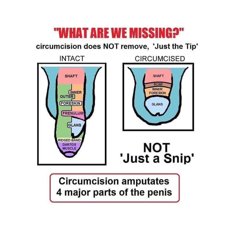 Male Circumcision The Unkindest Cut Freshmag