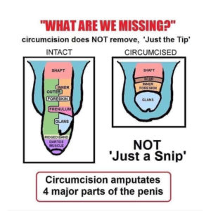 Male Circumcision The Unkindest Cut